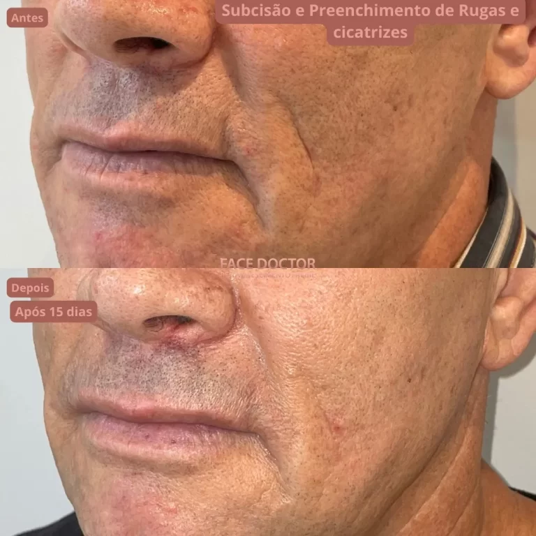 WhatsApp Image 2023-07-19 at 16.45.15 (1)_4_11zon