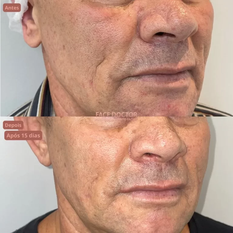 WhatsApp Image 2023-07-19 at 16.45.15 (2)_5_11zon